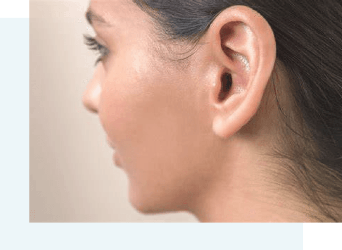 Child with ear difference before consultation for treatment options