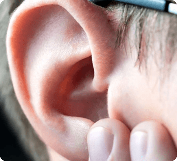 Ear anatomy diagram showing lidding or lop ear, prominent ears, and buried ear conditions